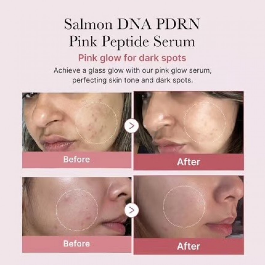 MEDICUBE > PDRN Pink Peptide Serum 30ml
